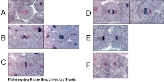 <strong>In the diagram,which panel shows the kinetochore of the centromeres aligning along the center of the mitotic spindle of the cell? </strong> A)A B)B C)C D)D E)E