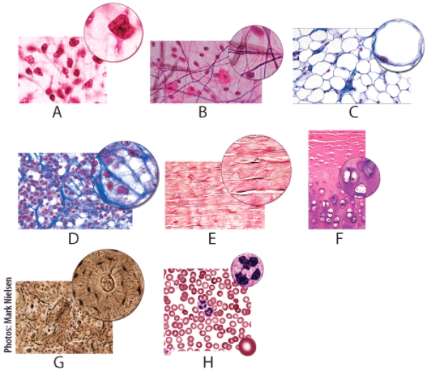 <strong>Which of the following figures shows tissue found along the developing bones of the embryo?  </strong> A)A B)B C)C D)E E)F <div style=padding-top: 35px> 