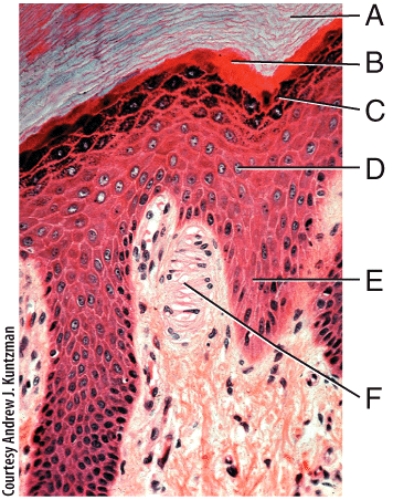 <strong>In the photomicrograph of a portion of thick skin shown below,which layer is only seen in thick skin? </strong> A)A B)B C)C D)D E)E