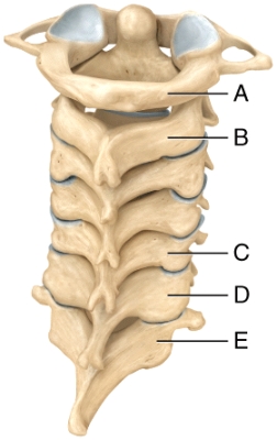 <strong>Which of the cervical vertebrae are responsible for permitting the movement of the head seen when saying yes? </strong> A)A B)B C)C D)D E)E