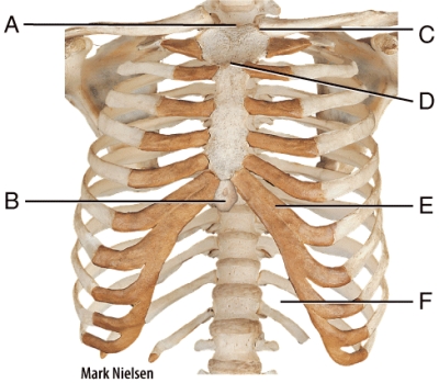 <strong>Where is the clavicular notch? </strong> A)A B)C C)D D)B E)F