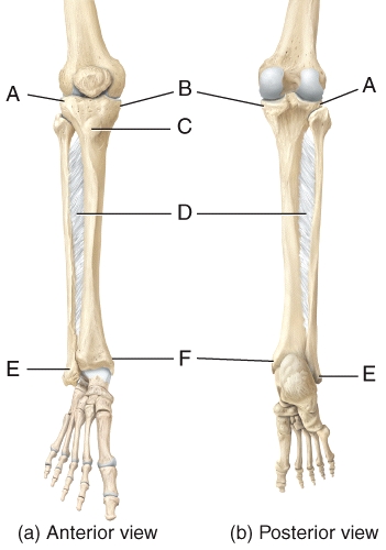 <strong>In the diagram of the tibia and fibula,where is the tibial tuberosity? </strong> A)B B)C C)E D)F E)G