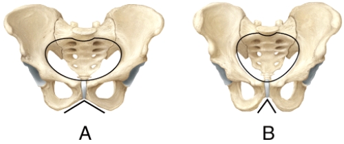 <strong>Which pelvis in the diagram shows the characteristics of a female pelvis? </strong> A)A B)B C)Both are male.