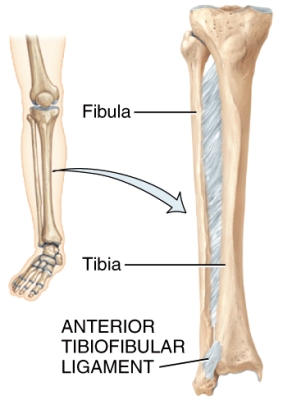<strong>What type of joint is shown in the diagram?  </strong> A)Suture B)Syndesmosis C)Symphysis D)Cartilaginous E)Synovial <div style=padding-top: 35px> 
