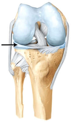 <strong>The line is pointing to the _____.  </strong> A)lateral meniscus B)medial meniscus C)anterior cruciate ligament D)posterior cruciate ligament <div style=padding-top: 35px> 