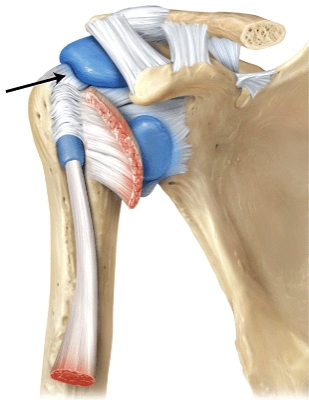<strong>The line is pointing to the _____ ligament.  </strong> A)coracoacromial B)acromioclavicular C)glenohumeral D)coracohumeral <div style=padding-top: 35px> 