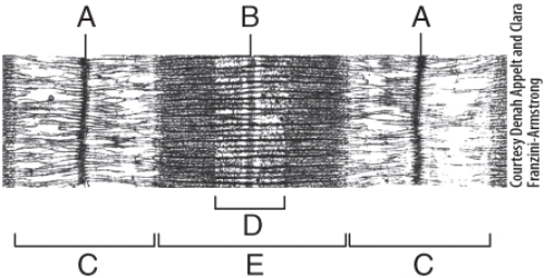 <strong>In the diagram,where are thick filaments found?  </strong> A)C B)E C)A D)B E)All of these choices <div style=padding-top: 35px> 