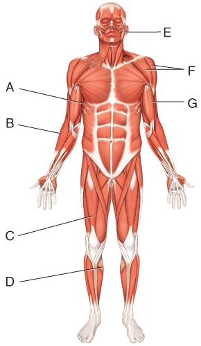<strong>Where is the masseter? </strong> A)A B)B C)G D)I E)E