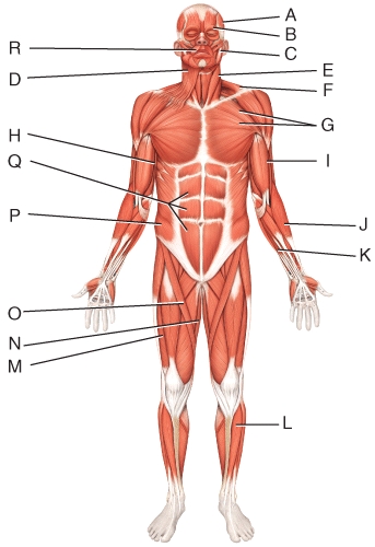 <strong>What is the origin of the muscle labeled B? </strong> A)upper lip B)mandible C)medial wall of orbit D)skin at the corner of the mouth E)skin of the eyebrow