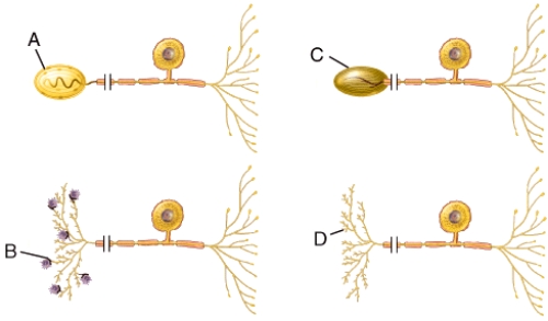 <strong>What specific type of unipolar neuron is shown in the diagram labeled B?  </strong> A)Type I cutaneous mechanoreceptor (Merkel disc) B)Corpuscle of touch (Meissner corpuscle) C)Lamellated (Pacinian)corpuscle D)nociceptor E)Purkinje cell <div style=padding-top: 35px> 
