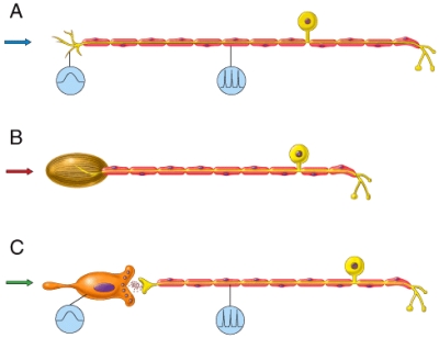 <strong>Which of the neurons in the diagram would most likely pick up an itch sensation? </strong> A)A B)B C)C D)Both A and B E)All of these choices