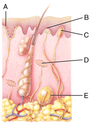 <strong>Which of the labeled structures in the diagram is a pain receptor? </strong> A)A B)B C)C D)D E)E