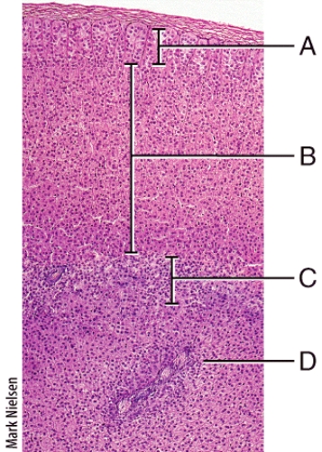 <strong>Which of the following hormones is produced in zone of adrenal gland labeled B? </strong> A)cortisol B)epinephrine C)norepinephrine D)glucagon E)androgens