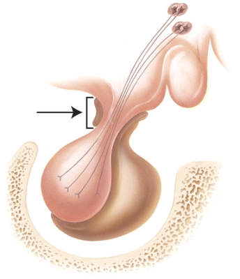 <strong>Identify the stalk-like structure labeled A in the diagram. </strong> A)hypothalamus B)anterior pituitary C)posterior pituitary D)infundibulum E)hypophyseal fossa