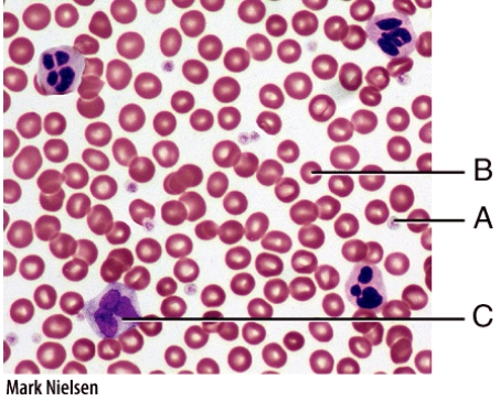 <strong>Which labeled cell in the diagram is a WBC? </strong> A)A B)B C)C D)Both B and C E)All of these choices