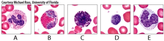 <strong>A high count of which of the white blood cells shown in the figure may indicate cancer or hypothyroidism? </strong> A)A B)B C)C D)D E)E