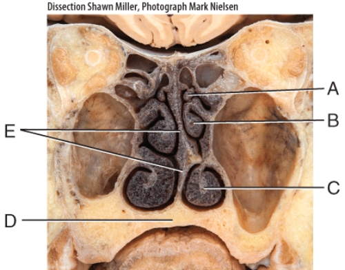 <strong>What is E pointing to?  </strong> A)Soft palate B)Ethmoid bone C)Hard palate D)Nasal septum E)Air cells <div style=padding-top: 35px> 