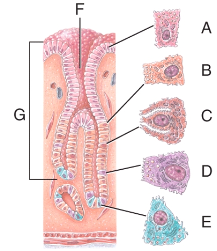 <strong>Name the structure labeled G  </strong> A)Parietal cell B)Gastric glands C)Gastric pit D)Chief cell E)Simple columnar epithelium <div style=padding-top: 35px> 