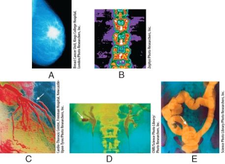 <strong>Which radiographs were obtained using low-dose x-rays? </strong> A)(A)and (B) B)(B)and (C) C)(C)and (D) D)(A)and (C) E)(B)and (E)
