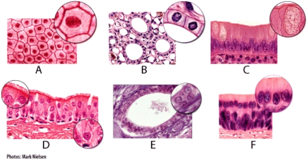 <strong>Which of the light micrographs in the figure below can be found in serous membranes? </strong> A)A B)B C)C D)D E)E