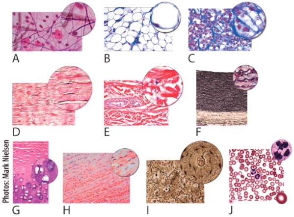 In the figure shown,light micrograph [___] will be located in red bone marrow and in the spleen to help with filtering.   Dropdown choices: A B C D E F G H I J<div style=padding-top: 35px> 