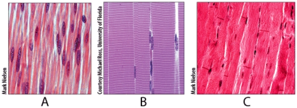 <strong>In the figure shown,which light micrograph contains autorhytmic cells? </strong> A)A B)B C)C