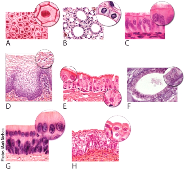 <strong>Which of the light micrographs in the following figure shows the type of epithelial tissue whose structure allows it to be stretched or distended? </strong> A)A B)D C)E D)G E)H