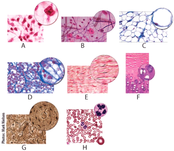 <strong>Which figure shows tissue that is found in the trachea? </strong> A)B B)C C)E D)F E)G