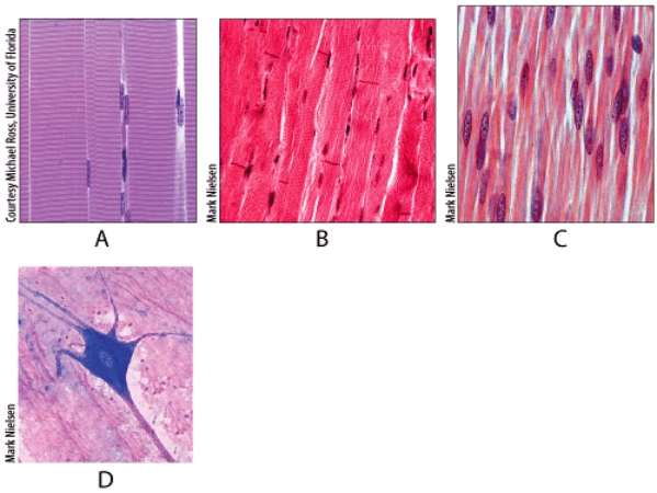 <strong>Which is a function of the tissue shown in diagram A? </strong> A)heat production B)pumping of blood C)propulsion of food D)contraction of bladder E)conduct nerve impulses to muscle fibers