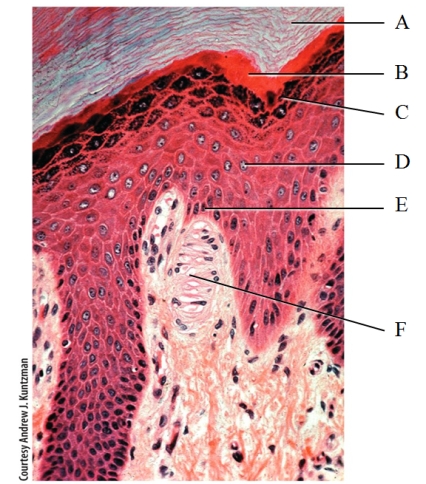 <strong>In the photomicrograph shown below,which layer will contain melanocyte projections,keratinocytes and intraepidermal macrophages (Langerhan cells)? </strong> A)A B)B C)C D)D E)E