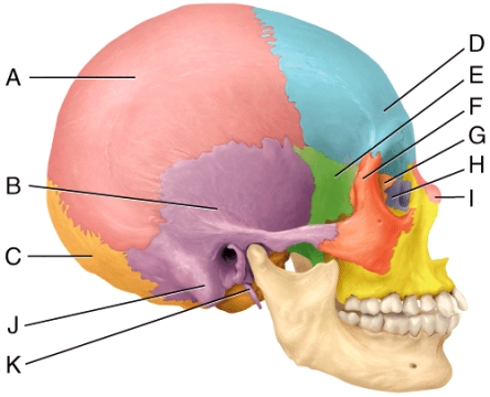 <strong>In the diagram,which bone is considered the keystone of the cranial floor? </strong> A)E B)B C)G D)H E)I