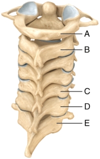<strong>In the diagram,which of the cervical vertebrae contains the articular surface that permits the movement of the head seen when saying yes? </strong> A)A B)B C)C D)D E)E