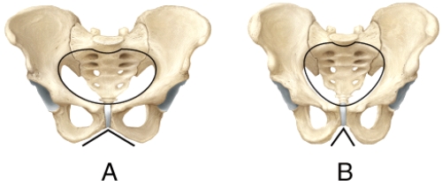 <strong>Which pelvis in the diagram shows the characteristics of a female pelvis? </strong> A)A B)B C)Both are male