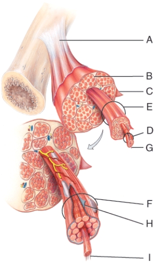 <strong>Which of the following structures are made of dense regular connective tissue? </strong> A)F B)A C)I D)Both F and I