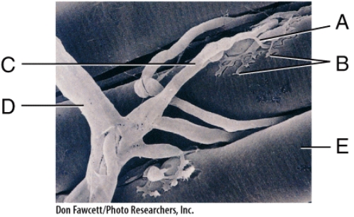 <strong>In the diagram,calcium ions will rush into this area. </strong> A)B B)C C)D