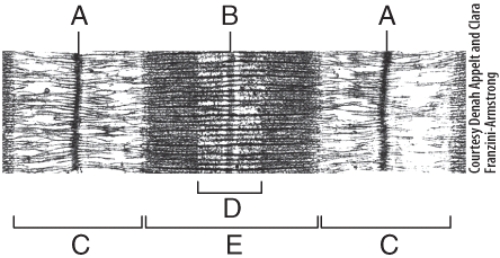 <strong>In the diagram,what area is composed of only thick filaments? </strong> A)C B)E C)A D)B E)D