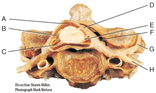 <strong>In this diagram,where would the axons of unipolar neurons be located? </strong> A)B B)C C)D D)E