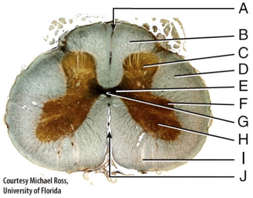 <strong>In this diagram which area is continuous with the 4<sup>th</sup> ventricle of the brain? </strong> A)A B)B C)G D)J E)I