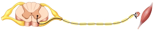 <strong>_____ is the neurotransmitter used by the pathway shown in the diagram and it causes ____.  </strong> A)Norepinephrine;depolarization B)Acetylcholine;depolarization C)Epinephrine;depolarization D)Norepinephrine;hyperpolarization E)Acetylcholine;hyperpolarization <div style=padding-top: 35px> 
