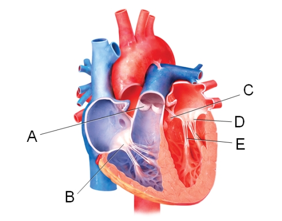 In the diagram,which labeled structure is the pulmonary semilunar valve?