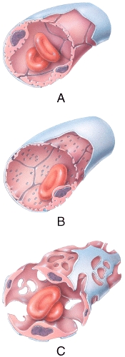 <strong>Which of the types of capillaries shown in the figure is commonly found in the kidneys,villi of the small intestine,choroid plexuses,and some endocrine glands? </strong> A)A B)B C)C D)A and B E)B and C