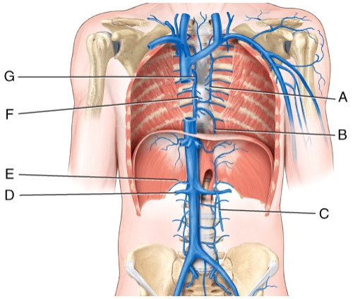 <strong>Which vessel in the figure is labeled C? </strong> A)accessory hemiazygos vein B)hemiazygos vein C)left gonadal vein D)right renal vein E)right suprarenal vein