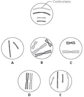 Use the following information to answer the questions below. The unlettered circle at the top of Figure 9.1 shows a diploid nucleus with four chromosomes that have not yet replicated. There are two pairs of homologous chromosomes, one long and the other short. One haploid set is black, and the other is gray. The circles labeled A-E show various combinations of these chromosomes. Figure 9.1 -What is the correct chromosomal condition for one daughter nucleus at telophase of mitosis?