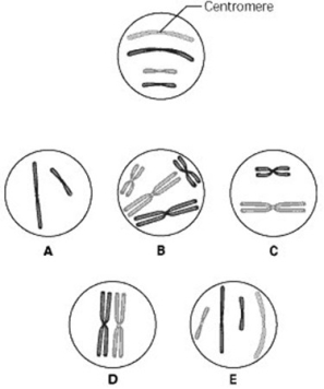 <strong>Use the figure to answer the question below. The unlettered circle at the top of the figure shows a diploid nucleus with four chromosomes that have not yet replicated. There are two pairs of homologous chromosomes, one long and the other short. One haploid set is black, and the other is grey. The circles labelled A to E show various combinations of these chromosomes. What is the correct chromosomal condition at prometaphase of mitosis?</strong> A) B B) C C) D D) E