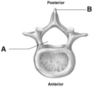   -The structure designated by the letter A is the