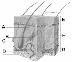 <strong> In the figure, the letter A best represents</strong> A) a sweat gland. B) a sebaceous gland. C) the subcutaneous tissue. D) an arrector pili muscle. E) a hair follicle.