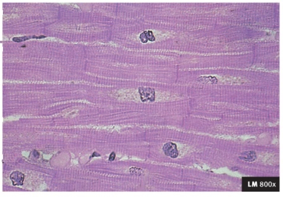 <strong>    The type of muscle shown in the diagram is</strong> A) cardiac B) smooth C) skeletal <div style=padding-top: 35px> 