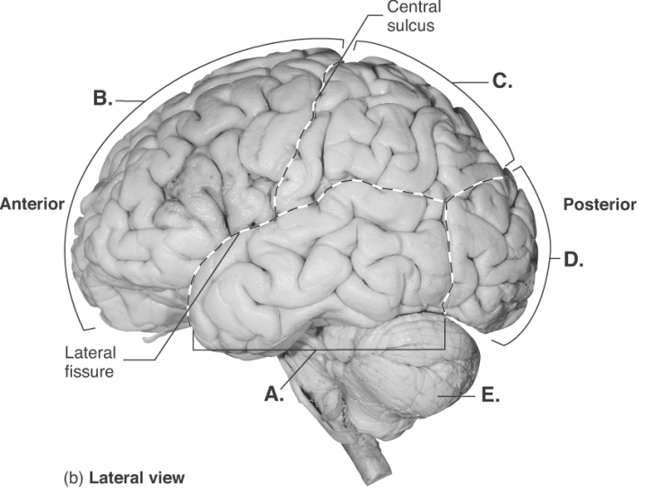 -This is a lateral view of the brain. What does A represent?