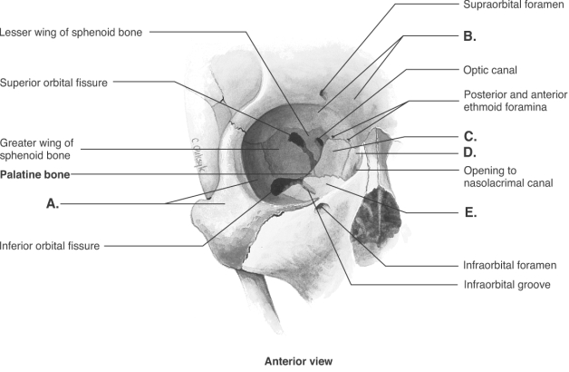 -The figure shows the bones of the right orbit. What bone does B represent?