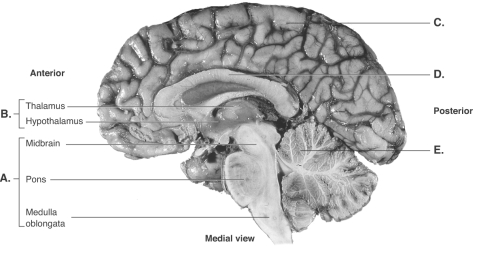 -This is a midsagittal section of the right half of the brain.What does C represent?